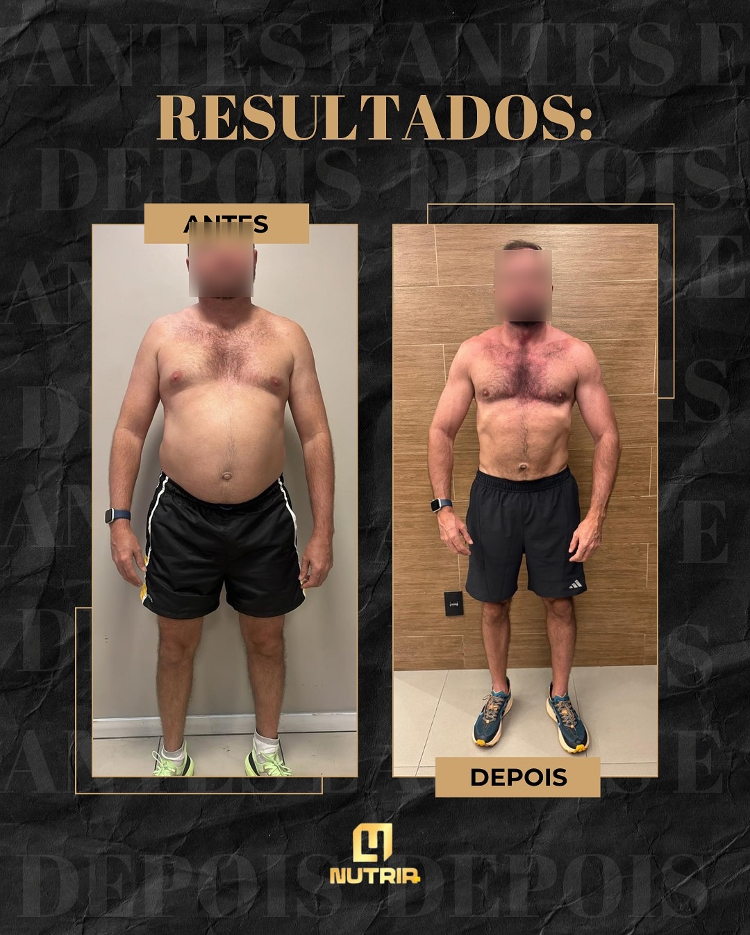 Transformação 4 - Antes e Depois -22kg